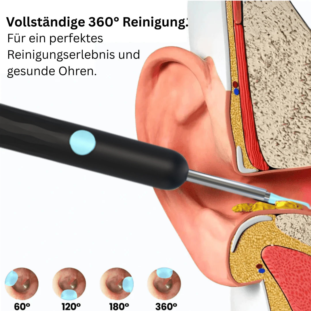 ⏳Begrenzte Zeit 50% Rabatt💥Intelligenter wasserdichter visueller Ohrenschmalzentferner